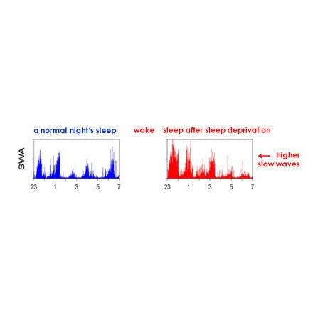 1_1_1_chronohealth_lighttherapy_2process_swa_sd.png