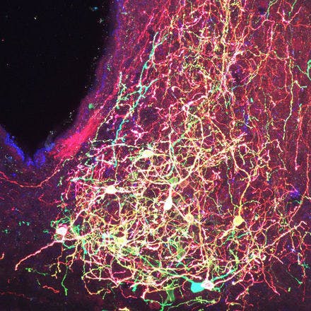 4_1_4_1_suprachiasmaticnucleusinmammals_brainbowpvnvipneurons-maxip1.png