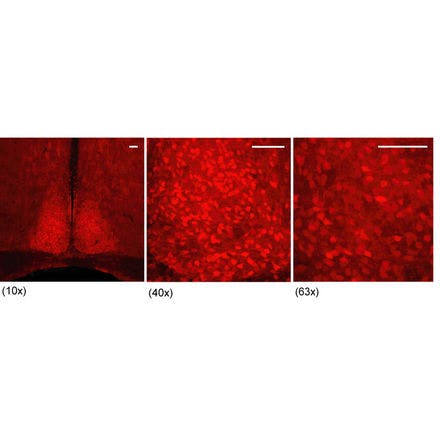 4_1_4_1_suprachiasmaticnucleusinmammals_camicre-tdtomato.png