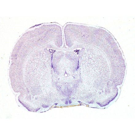 4_1_4_1_suprachiasmaticnucleusinmammals_dsc_0849.png