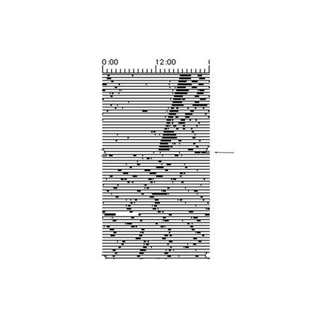 4_1_4_1_suprachiasmaticnucleusinmammals_lesion.png