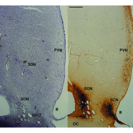 4_1_4_1_suprachiasmaticnucleusinmammals_swaab_thionine_vasopressin_humancontrol.png