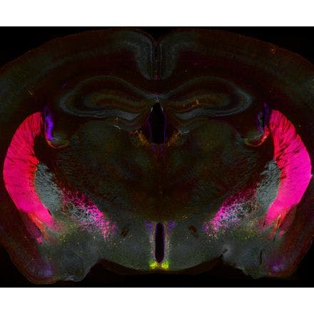 compressed_4_1_4_1_suprachiasmaticnucleusinmammals_chronoexhibition_mouse_brain_section_suprachiasmatic nucleus.jpg